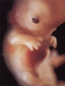 фотография плода на 11 неделе беременности