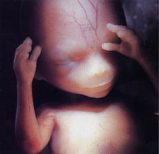 фото плода на 15 неделе беременности