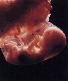 фото плода 16 неделя беременности