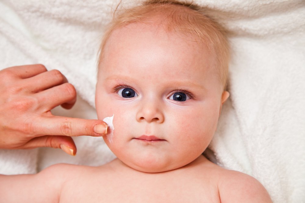 ребенок с красными щеками от аллергического диатеза